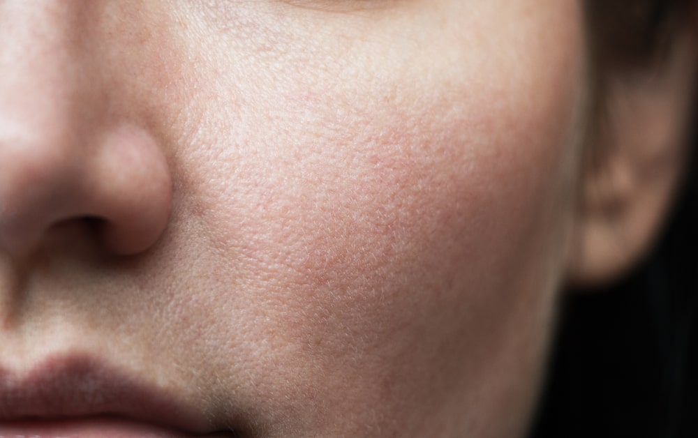 Best Facial Treatments for Sensitive Skin | Mouda Laser & Skin Clinic